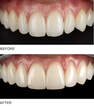 composite-example1