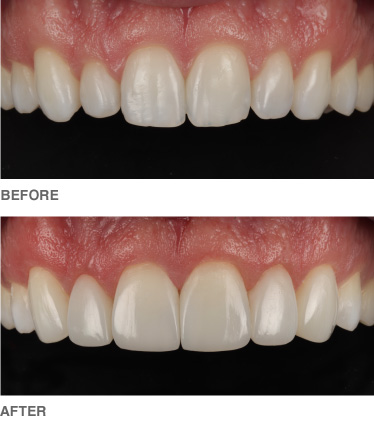 composite-example2