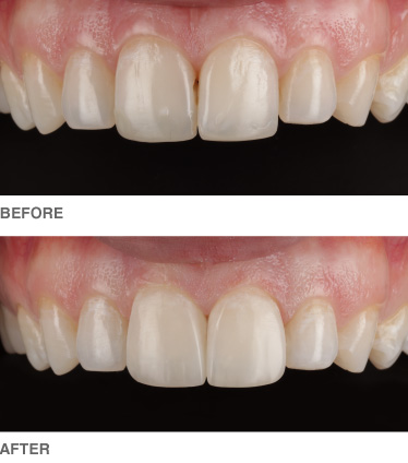 composite-example3