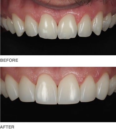 composite-example4
