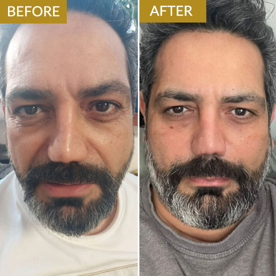 polynucleotides-example1 polynucleotides-example1