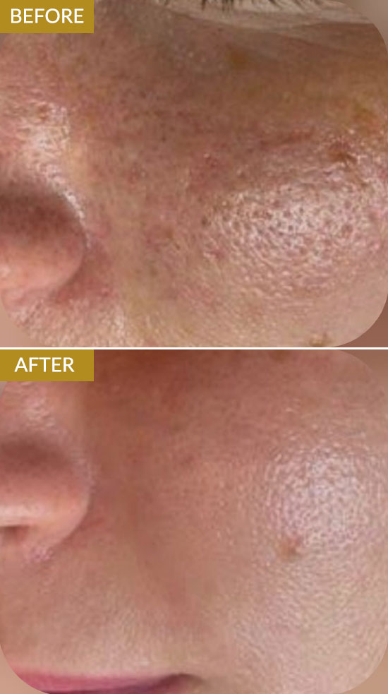 polynucleotides-example2 polynucleotides-example2