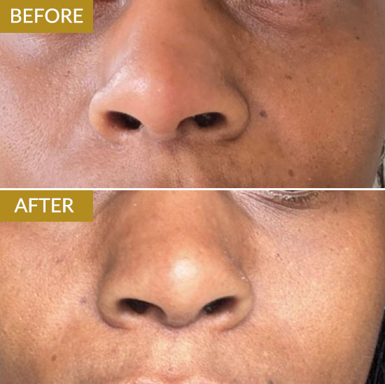 polynucleotides-example3 polynucleotides-example3